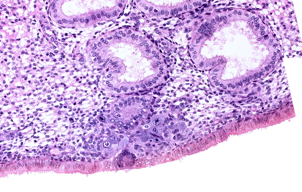edematous endometrial stroma (decidua), endometrial epithelium, endometrial gland, endometrial sinusoid, solid syncytiotrophoblast
