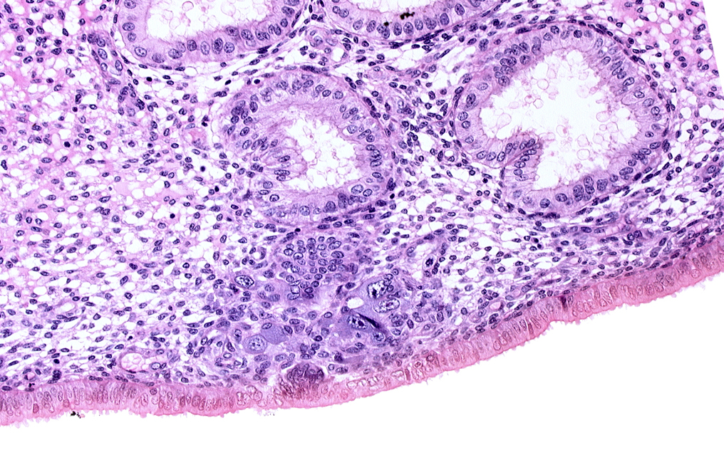 edematous endometrial stroma (decidua), endometrial epithelium, endometrial sinusoid, lumen of endometrial gland, solid syncytiotrophoblast
