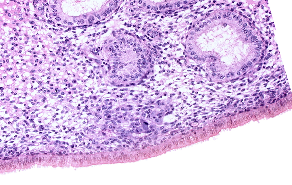 edematous endometrial stroma (decidua), endometrial epithelium, endometrial gland, endometrial sinusoid, lumen of endometrial gland, solid syncytiotrophoblast, uterine cavity