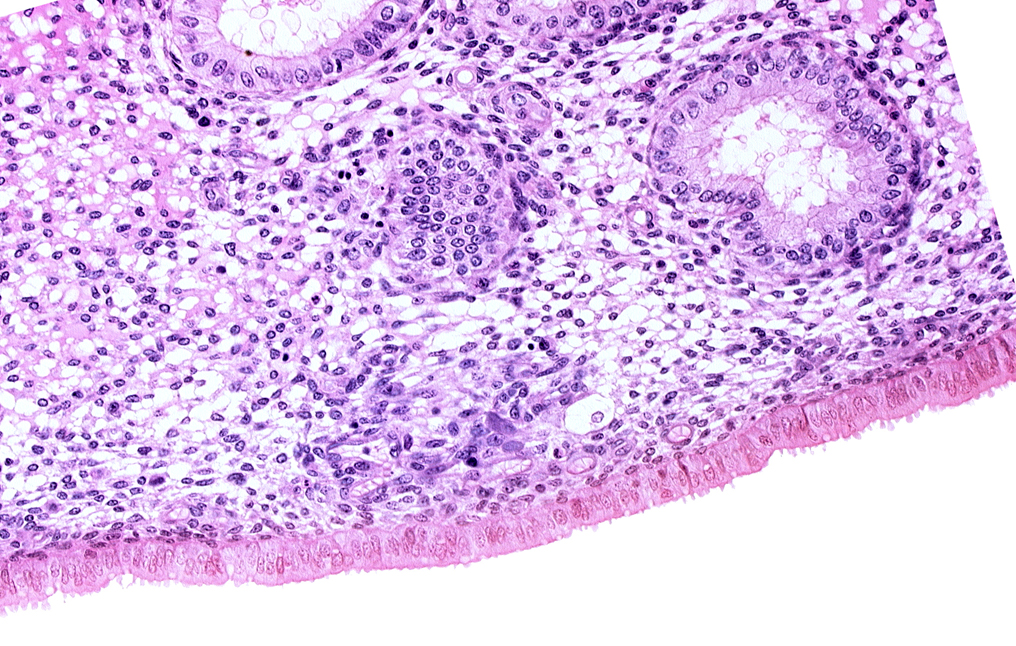 edematous endometrial stroma (decidua), endometrial gland, endometrial sinusoid, intact endometrial epithelium, solid syncytiotrophoblast, uterine cavity