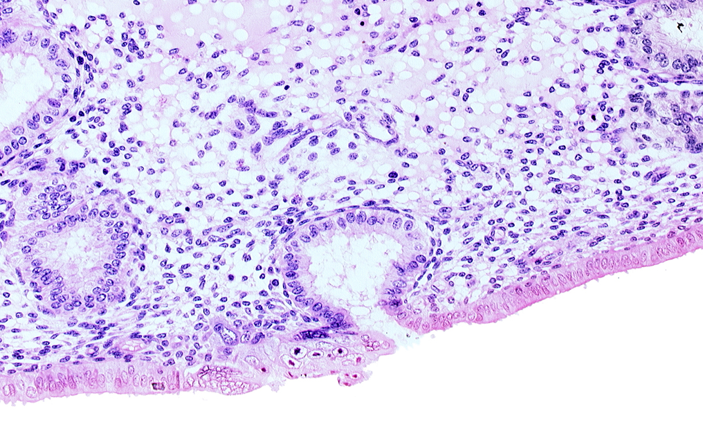 endometrial epithelium, lumen of endometrial gland, mouth of endometrial gland, solid syncytiotrophoblast