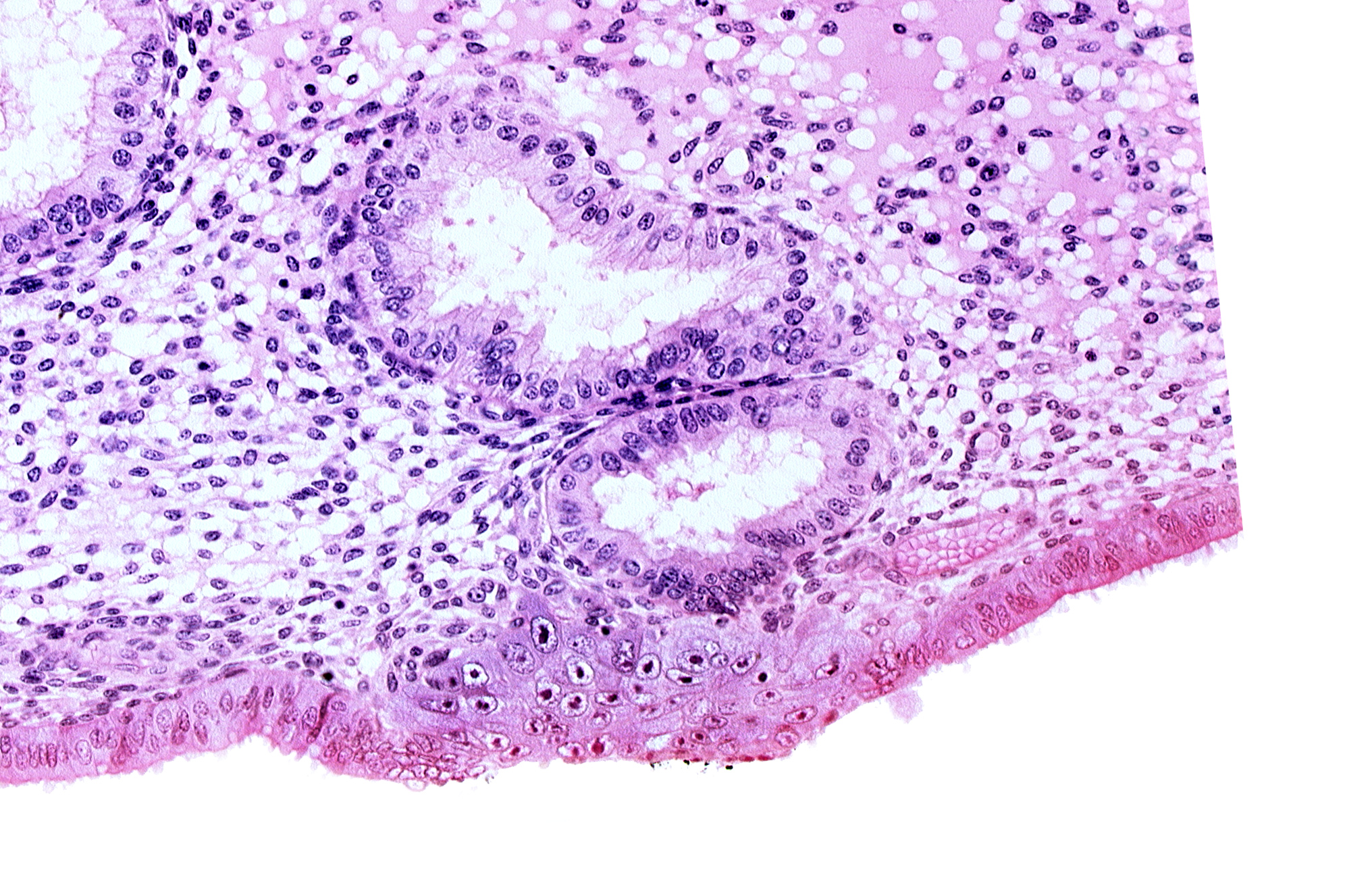 disrupted endometrial epithelium, edematous endometrial stroma (decidua), endometrial epithelium, endometrial gland, solid syncytiotrophoblast, uterine cavity