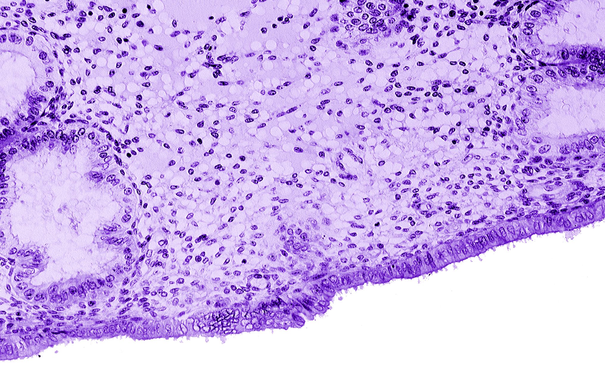 disrupted endometrial epithelium, edematous endometrial stroma (decidua), endometrial epithelium, lumen of endometrial gland