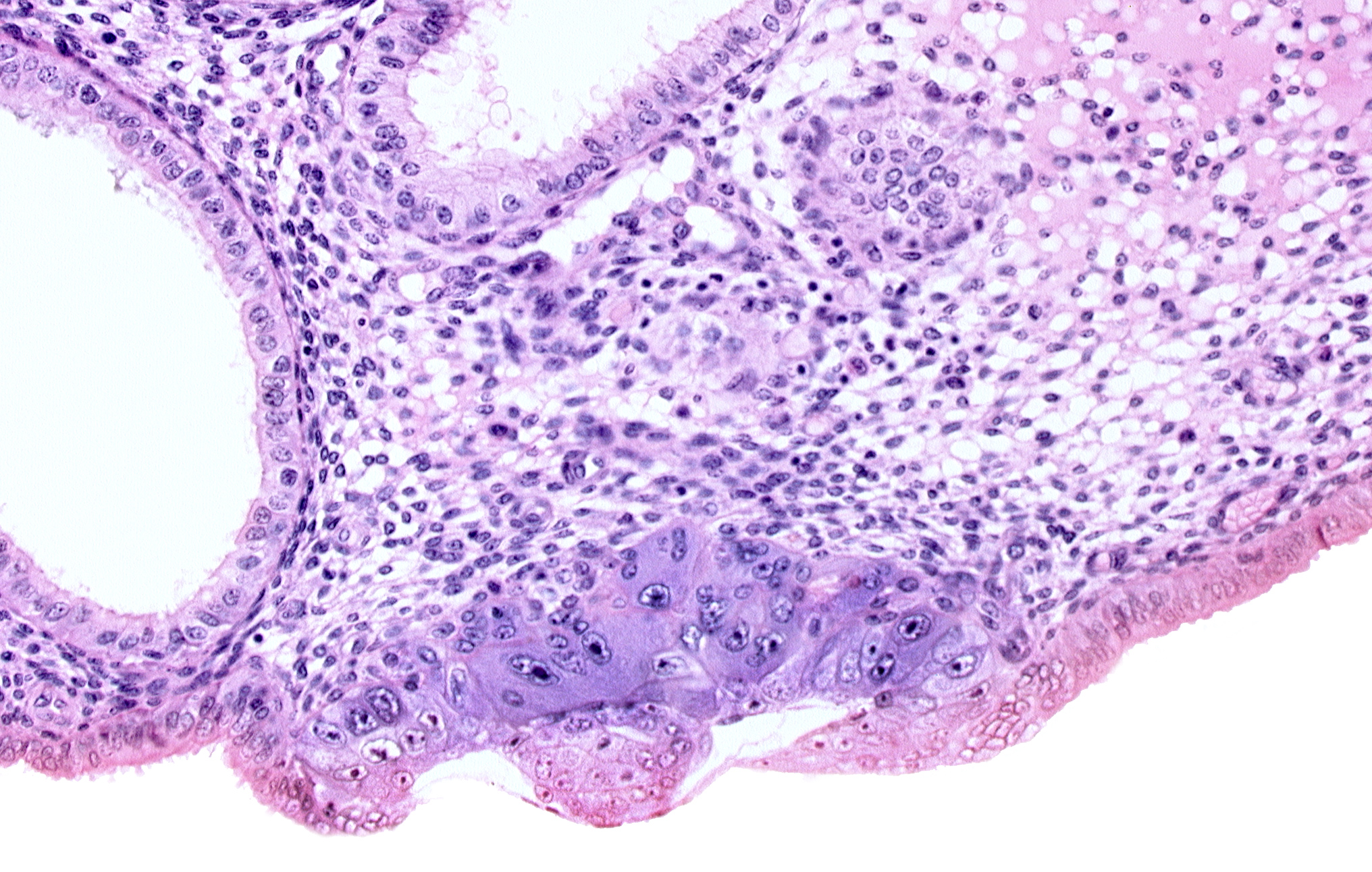amniotic cavity, blastocystic cavity (blastocoele), embryonic disc, endometrial epithelium, endometrial sinusoid, membranous trophoblast at abembryonic pole