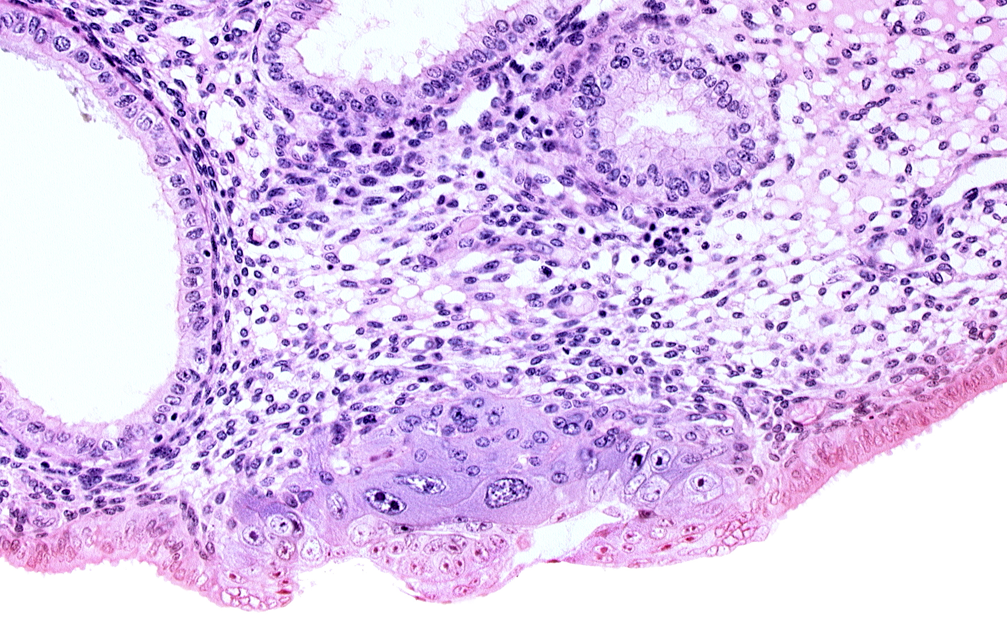 amniotic cavity, blastocystic cavity (blastocoele), embryonic disc, endometrial sinusoid, membranous trophoblast at abembryonic pole, solid syncytiotrophoblast, syncytiotrophoblast / decidua interface