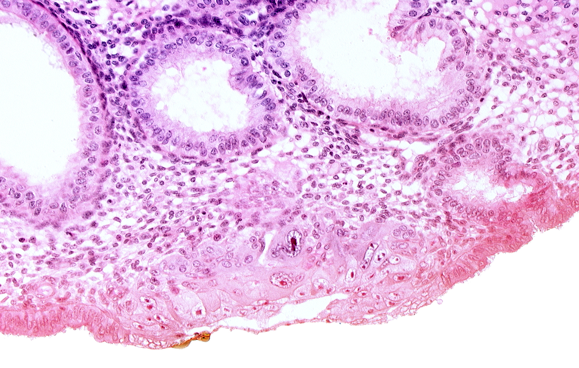 blastocystic cavity (blastocoele), cytotrophoblast, edematous endometrial stroma (decidua), edge of endometrial gland, embryonic disc, endometrial sinusoid, membranous trophoblast at abembryonic pole, solid syncytiotrophoblast, syncytiotrophoblast / decidua interface