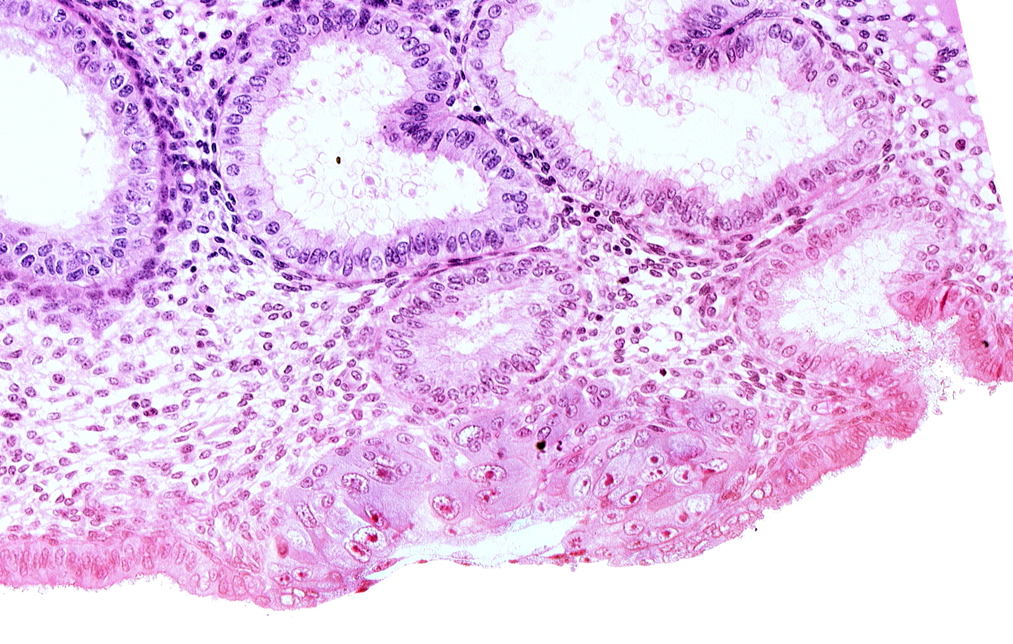 blastocystic cavity (blastocoele), endometrial epithelium, endometrial gland, membranous trophoblast at abembryonic pole, mouth of endometrial gland