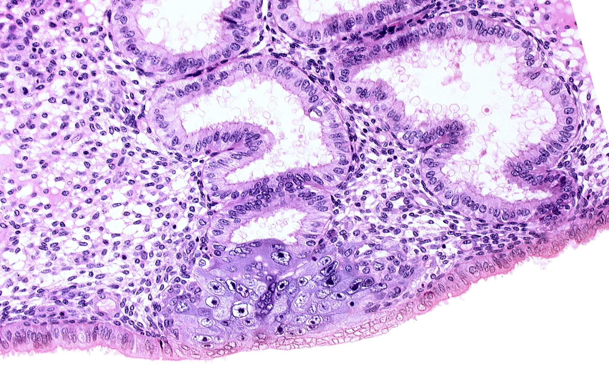 cytotrophoblast, edge of endometrial gland, endometrial epithelium, endometrial gland, endometrial sinusoid, solid syncytiotrophoblast, uterine cavity