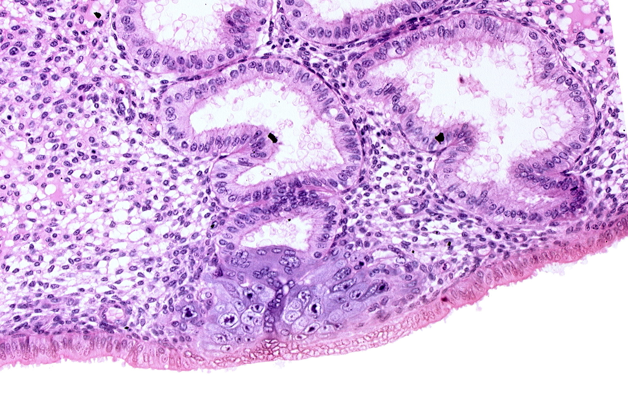 cytotrophoblast, edematous endometrial stroma (decidua), endometrial epithelium, endometrial sinusoid, lumen of endometrial gland, solid syncytiotrophoblast