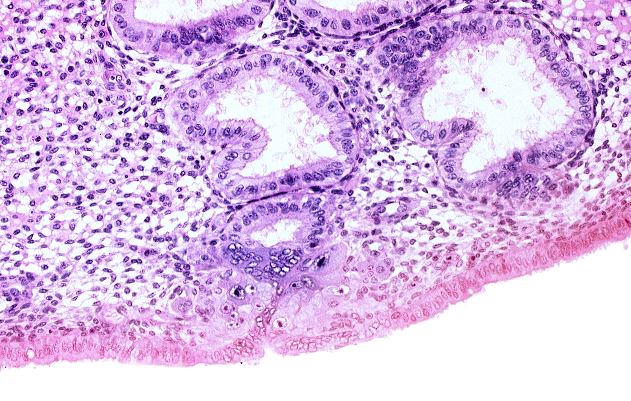 cytotrophoblast, endometrial epithelium, endometrial gland, endometrial sinusoid, solid syncytiotrophoblast, uterine cavity