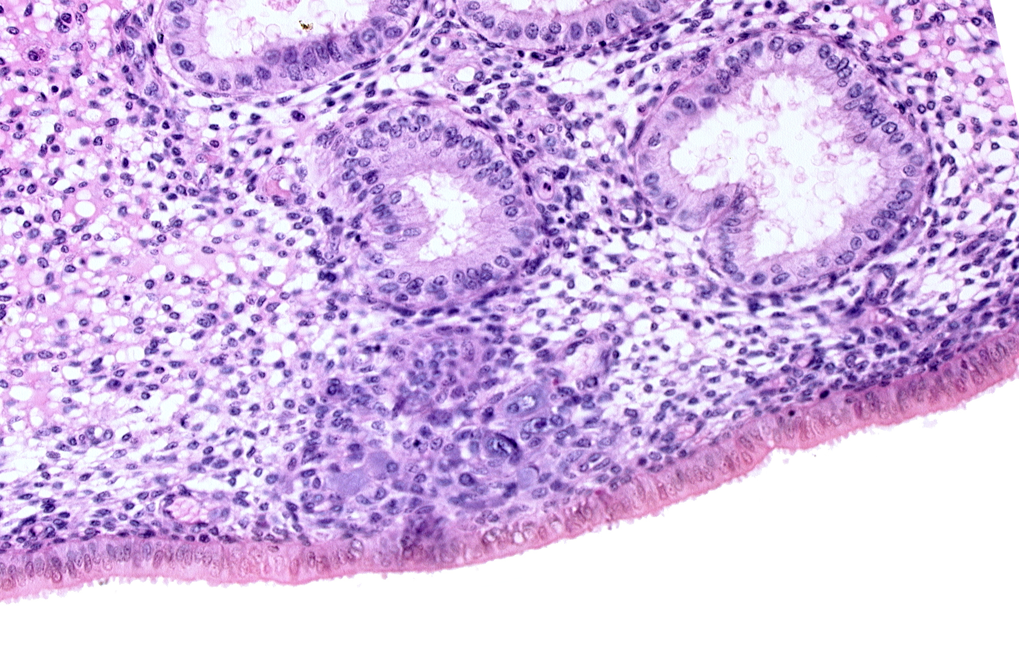endometrial epithelium, endometrial gland, endometrial sinusoid, solid syncytiotrophoblast, uterine cavity