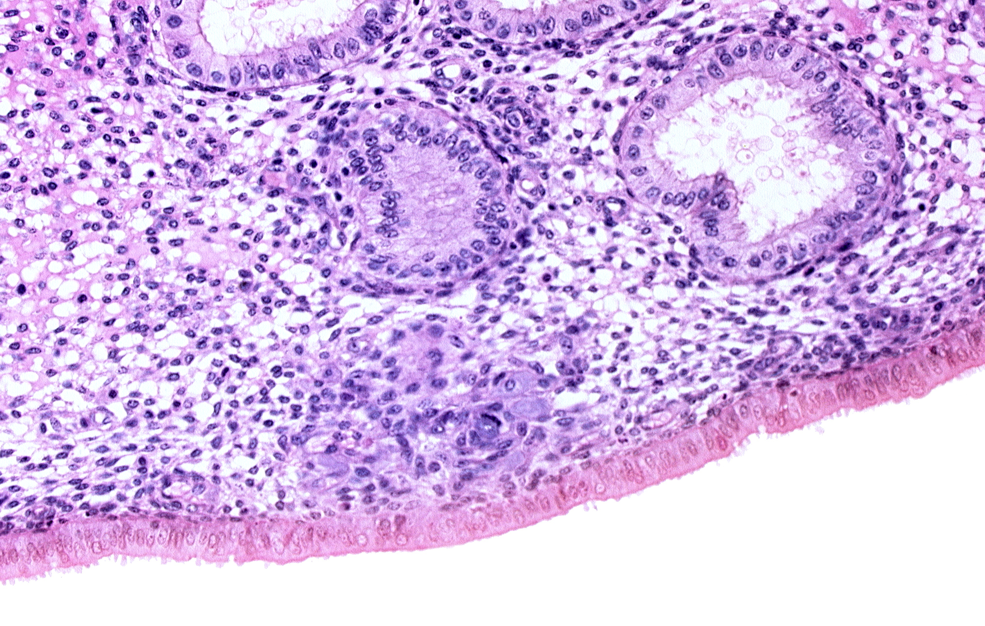 edematous endometrial stroma (decidua), endometrial epithelium, endometrial gland, endometrial sinusoid, lumen of endometrial gland, solid syncytiotrophoblast