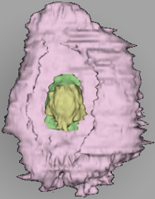 Stage 5a-1