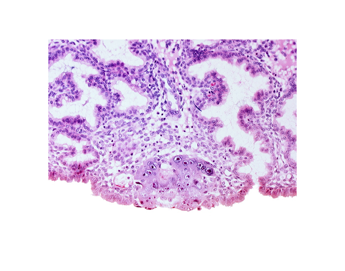 amnioblast(s), blastocystic cavity (blastocoele), edge of amniotic (tropho-epiblastic) cavity, epiblast, hypoblast, membranous trophoblast at abembryonic pole, syncytiotrophoblastic mass