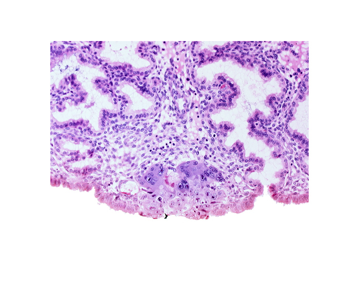 amnioblast(s), amniotic cavity, blastocystic cavity (blastocoele), mouth of adjacent endometrial gland, syncytiotrophoblast / decidua interface, uterine cavity