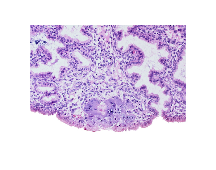 amniotic cavity, blastocystic cavity (blastocoele), endometrial sinusoid, membranous trophoblast at abembryonic pole