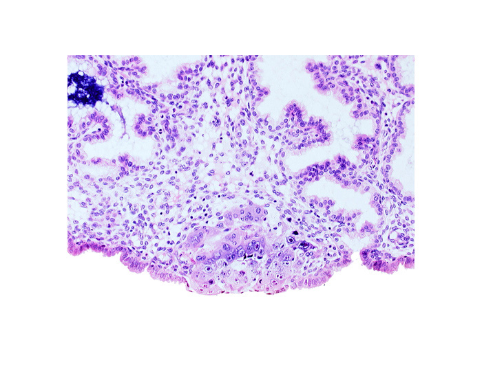 amniotic cavity, blastocystic cavity (blastocoele), epiblast, hypoblast, mitotic figure in epiblast, syncytiotrophoblastic mass, uterine cavity