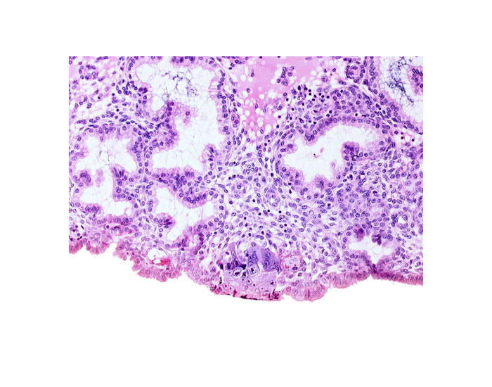 edge of cytotrophoblast, edge of syncytiotrophoblast, uterine cavity