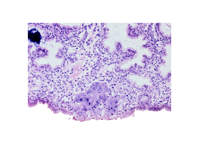 blastocystic cavity (blastocoele), cytotrophoblast, epiblast, hypoblast, syncytiotrophoblast