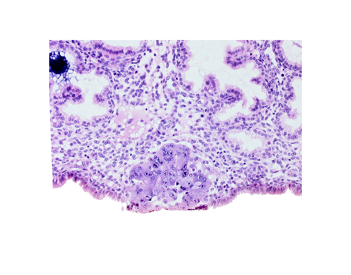 blastocystic cavity (blastocoele), epiblast, hypoblast, syncytiotrophoblast
