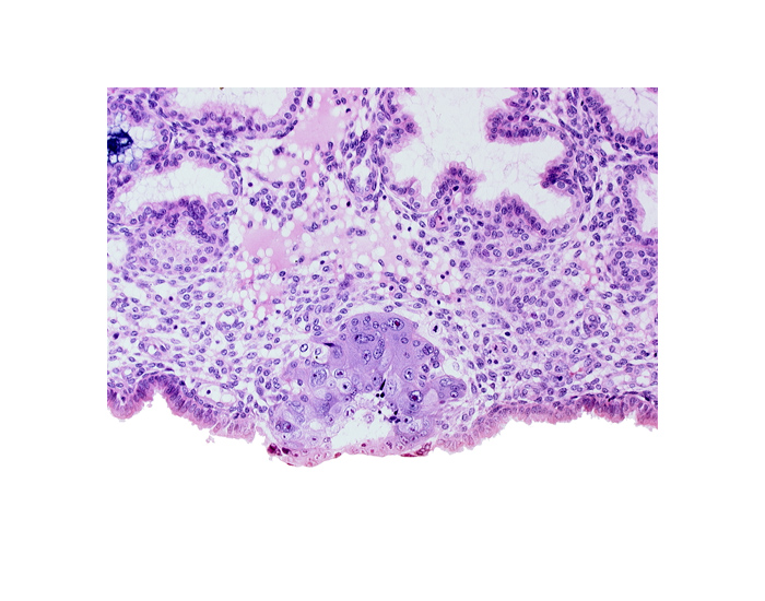 blastocystic cavity (blastocoele), edematous endometrial stroma (decidua), edge of embryonic disc, membranous trophoblast at abembryonic pole, solid syncytiotrophoblast