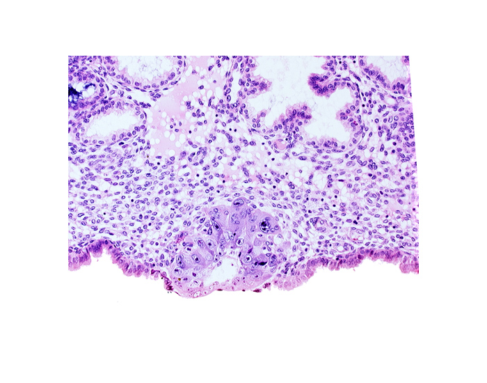blastocystic cavity (blastocoele), cytotrophoblast, edematous endometrial stroma (decidua), endometrial epithelium, solid syncytiotrophoblast, syncytiotrophoblast / decidua interface