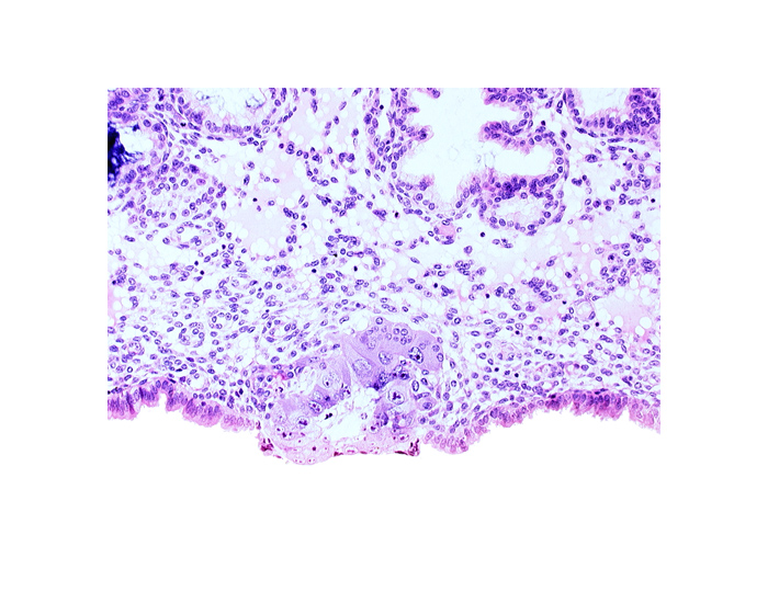 blastocystic cavity (blastocoele), cytotrophoblast, solid syncytiotrophoblast
