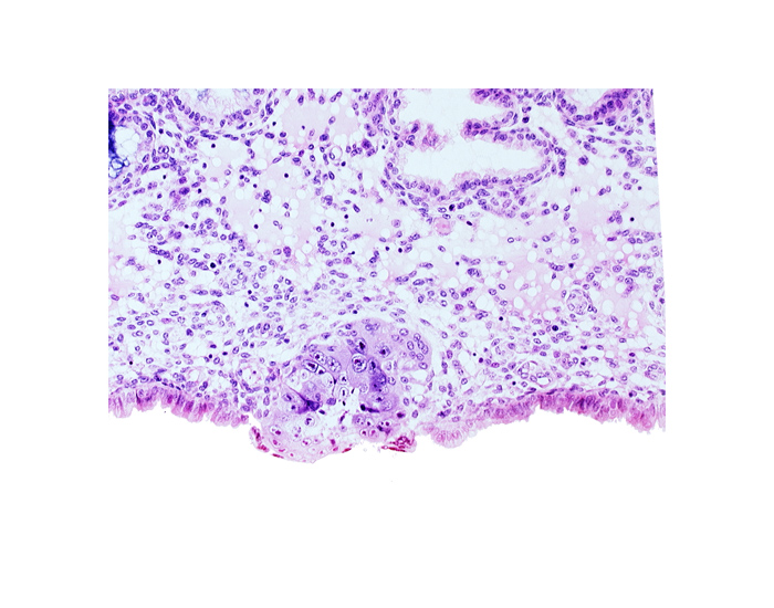 cytotrophoblast, edge of blastocystic cavity (blastocoele), solid syncytiotrophoblast