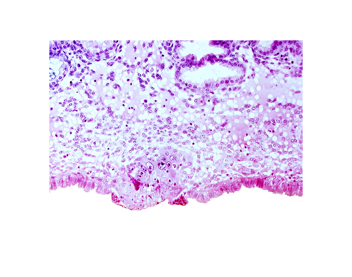 cytotrophoblast, edematous endometrial stroma (decidua), endometrial epithelium, solid syncytiotrophoblast, uterine cavity