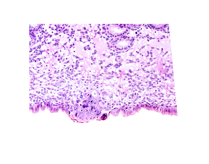 cytotrophoblast, edematous endometrial stroma (decidua), endometrial epithelium, endometrial sinusoid, syncytiotrophoblast, uterine cavity