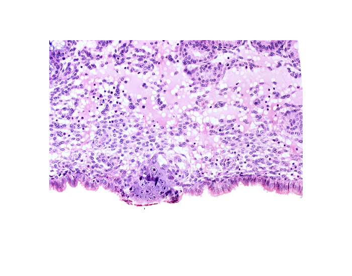 cytotrophoblast, edematous endometrial stroma (decidua), endometrial epithelium, endometrial sinusoid, membranous trophoblast at abembryonic pole