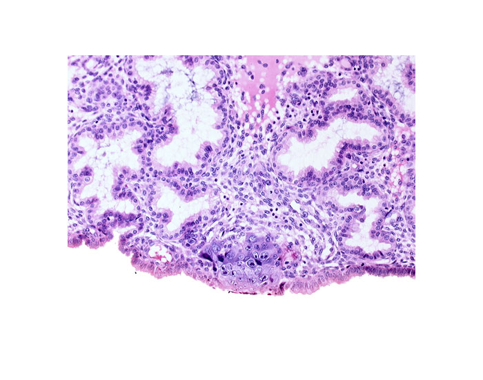 cytotrophoblast, endometrial epithelium, syncytiotrophoblast, syncytiotrophoblast / decidua interface, uterine cavity