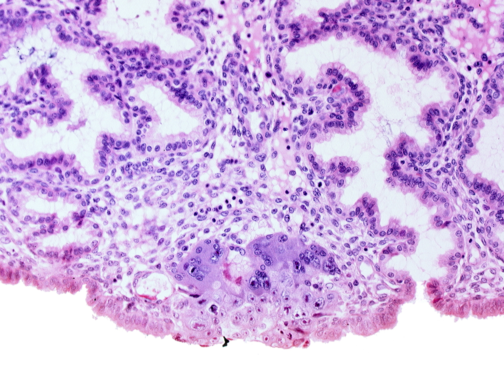 amnioblast(s), amniotic cavity, blastocystic cavity (blastocoele), mouth of adjacent endometrial gland, syncytiotrophoblast / decidua interface, uterine cavity