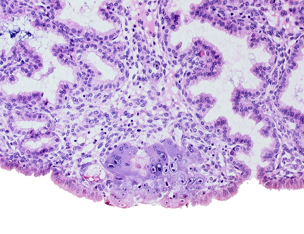 amniotic cavity, blastocystic cavity (blastocoele), endometrial sinusoid, membranous trophoblast at abembryonic pole