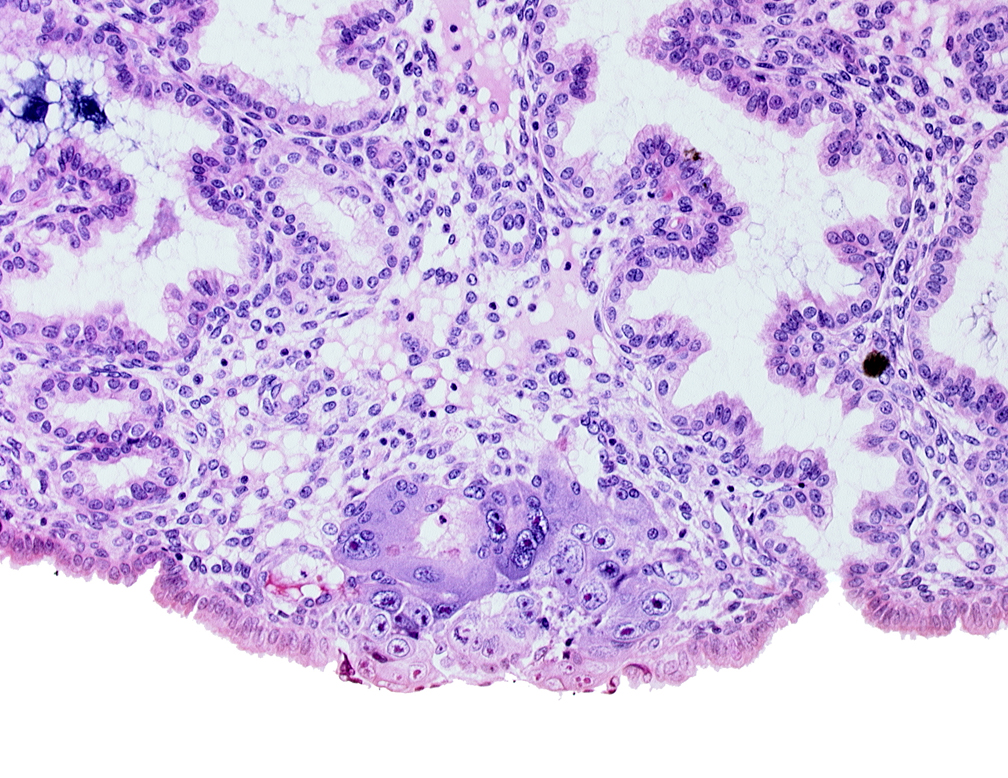 amniotic cavity, blastocystic cavity (blastocoele), edematous endometrial stroma (decidua), membranous trophoblast at abembryonic pole, syncytiotrophoblast / decidua interface, uterine cavity
