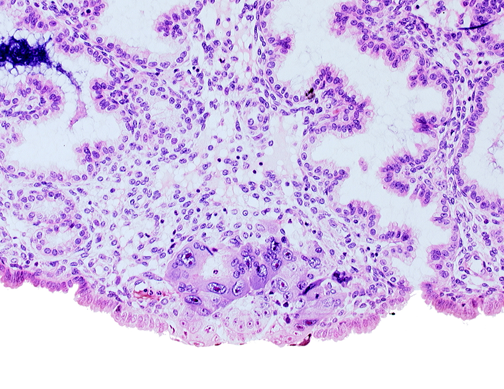 amniotic cavity, blastocystic cavity (blastocoele), epiblast, hypoblast, lumen of endometrial gland, membranous trophoblast at abembryonic pole, mouth of adjacent endometrial gland, solid syncytiotrophoblast