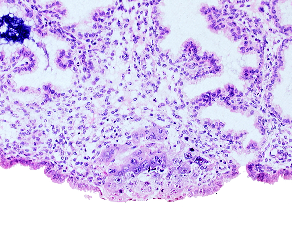 amniotic cavity, blastocystic cavity (blastocoele), epiblast, hypoblast, mitotic figure in epiblast, syncytiotrophoblastic mass, uterine cavity