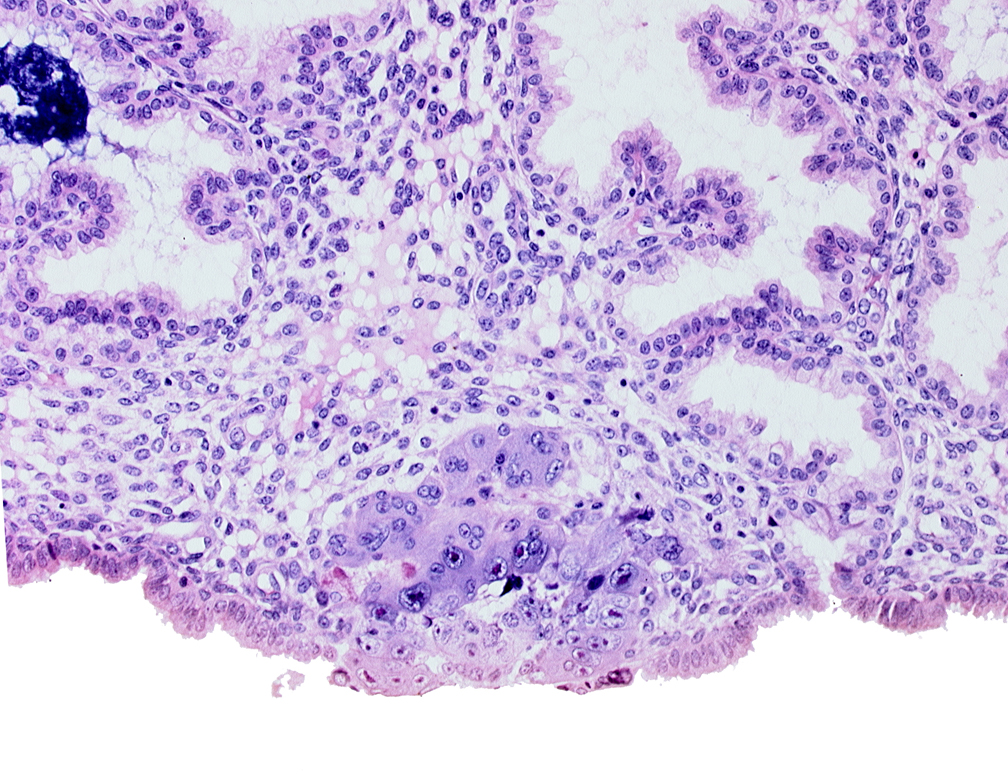 amniotic cavity, blastocystic cavity (blastocoele), solid syncytiotrophoblast, syncytiotrophoblast / decidua interface