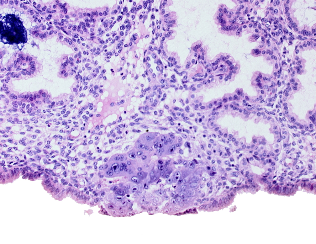 blastocystic cavity (blastocoele), edge of amniotic cavity, epiblast, hypoblast, membranous trophoblast at abembryonic pole, syncytiotrophoblast