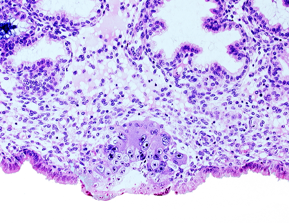 blastocystic cavity (blastocoele), cytotrophoblast, extra-embryonic mesoblast, solid syncytiotrophoblast