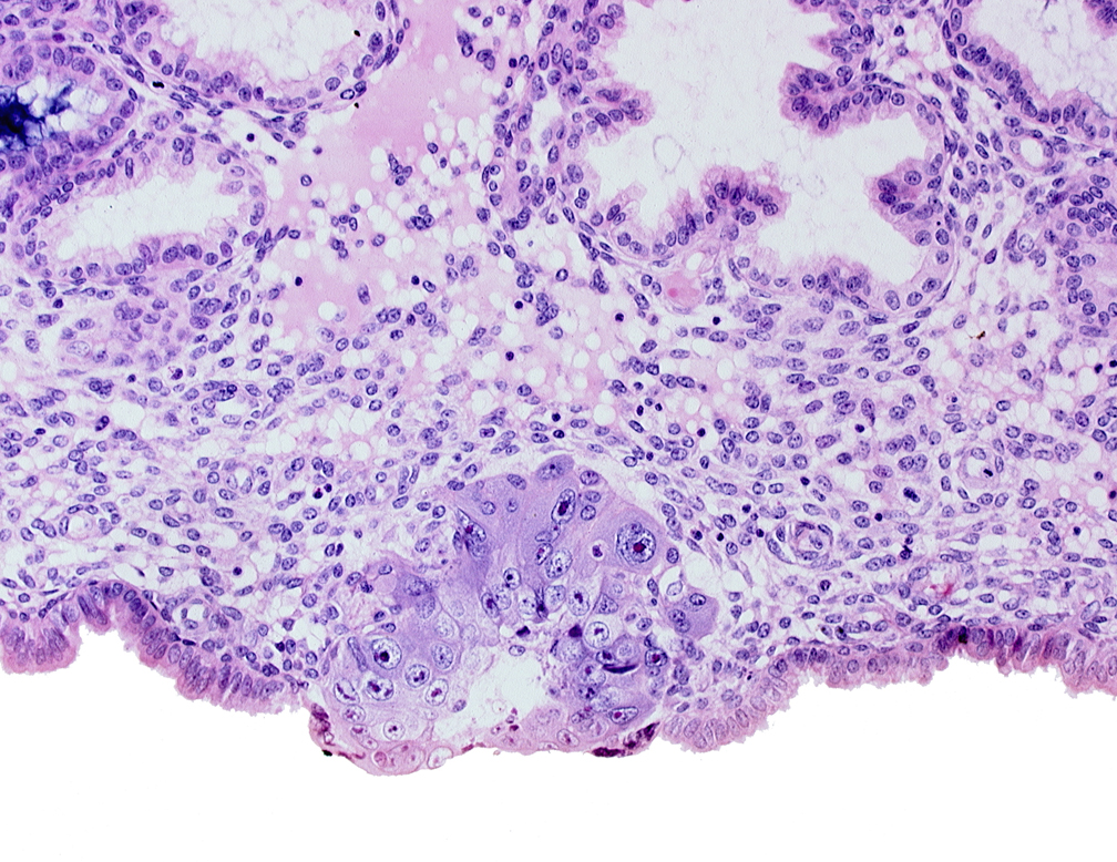 blastocystic cavity (blastocoele), cytotrophoblast, edge of membranous trophoblast at abembryonic pole, solid syncytiotrophoblast