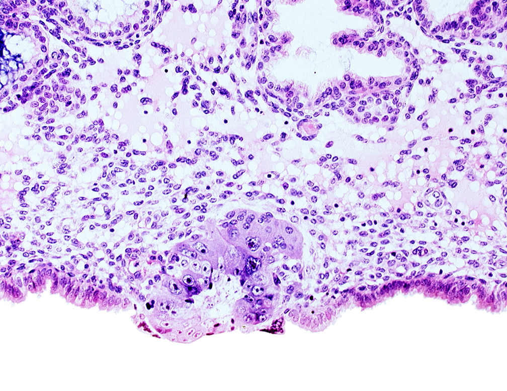 blastocystic cavity (blastocoele), syncytiotrophoblast, syncytiotrophoblast / decidua interface