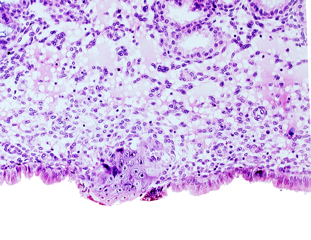 cytotrophoblast, edematous endometrial stroma (decidua), endometrial epithelium, endometrial sinusoid, syncytiotrophoblast / decidua interface, uterine cavity