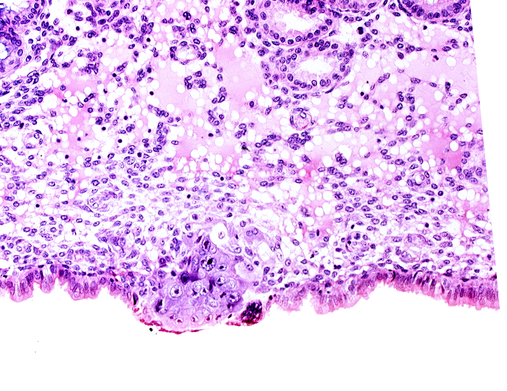 cytotrophoblast, edematous endometrial stroma (decidua), endometrial epithelium, endometrial sinusoid, syncytiotrophoblast, uterine cavity