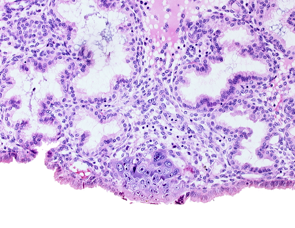 cytotrophoblast, endometrial epithelium, endometrial sinusoid, solid syncytiotrophoblast