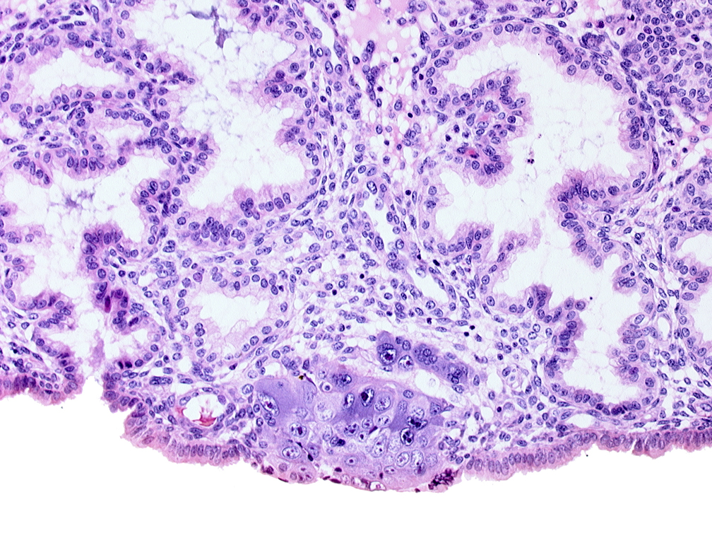 cytotrophoblast, edge of blastocystic cavity (blastocoele), endometrial sinusoid, lumen of adjacent endometrial gland, mouth of adjacent endometrial gland, syncytiotrophoblast, syncytiotrophoblastic mass