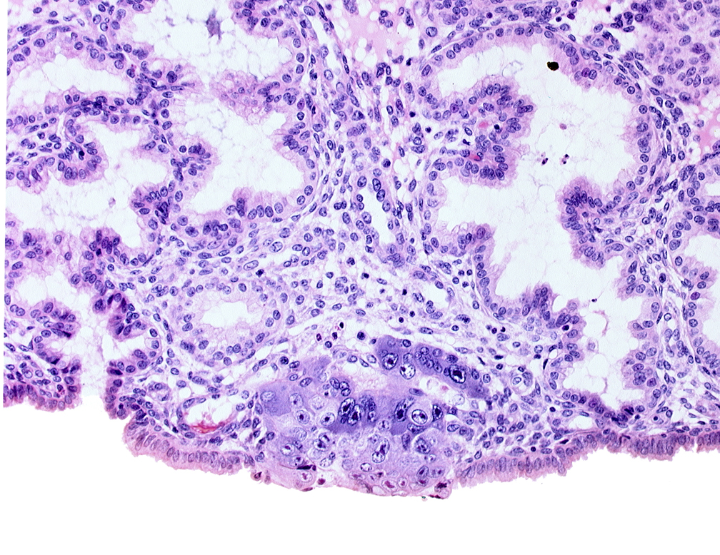blastocystic cavity (blastocoele), cytotrophoblast, edge of membranous trophoblast at abembryonic pole, endometrial sinusoid, syncytiotrophoblastic mass