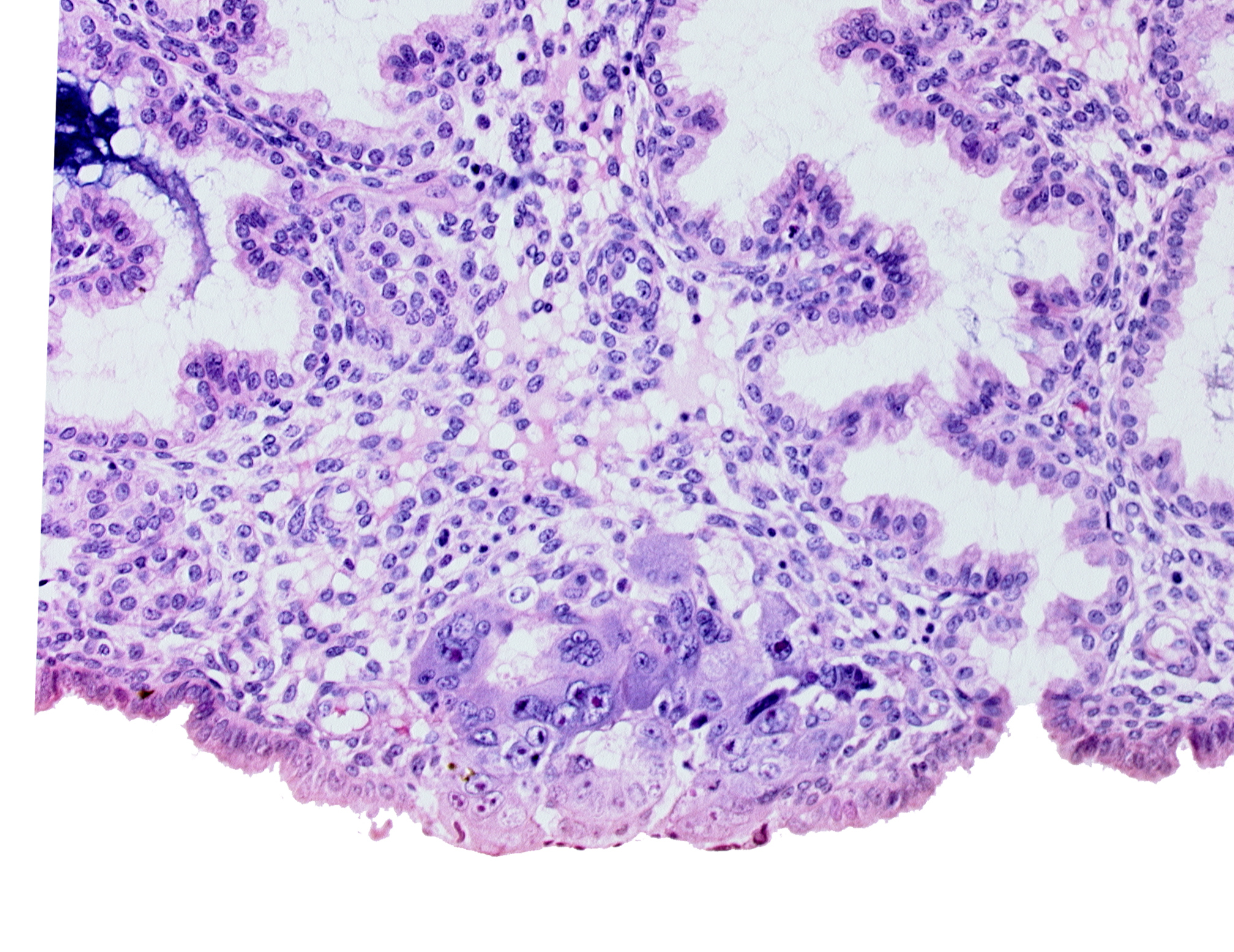 amniotic cavity, blastocystic cavity (blastocoele), epiblast, hypoblast, lumen of endometrial gland, membranous trophoblast at abembryonic pole, mouth of adjacent endometrial gland, solid syncytiotrophoblast
