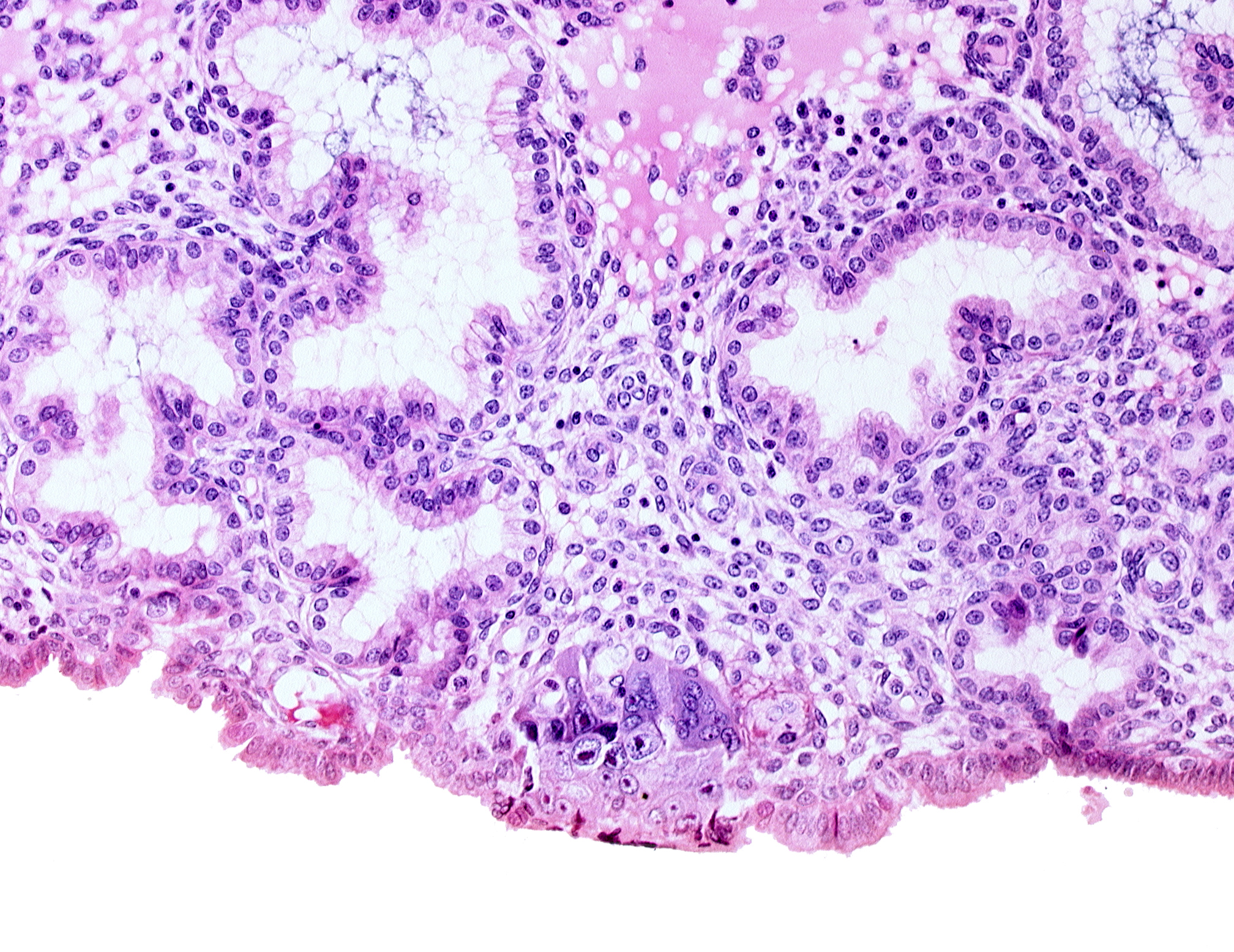 edge of cytotrophoblast, edge of syncytiotrophoblast, uterine cavity