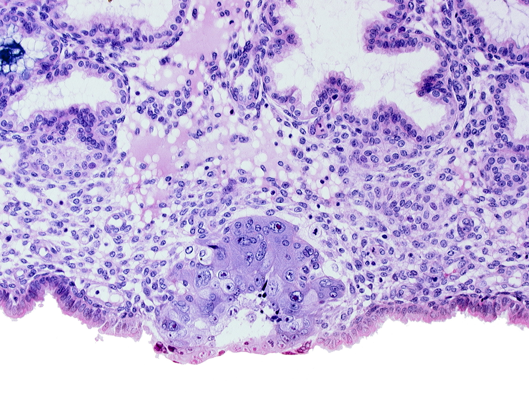 blastocystic cavity (blastocoele), edematous endometrial stroma (decidua), edge of embryonic disc, membranous trophoblast at abembryonic pole, solid syncytiotrophoblast
